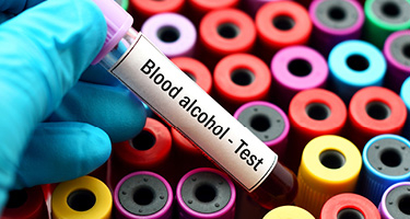 Gloved hand holding vial of blood for alcohol test