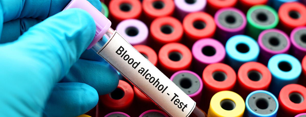 Gloved hand holding vial of blood for alcohol test