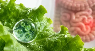 Taco Bell Cyclospora Suit: Supply Chain Liability 