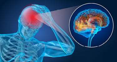 Blue Body X-Ray with Red Brain Injury